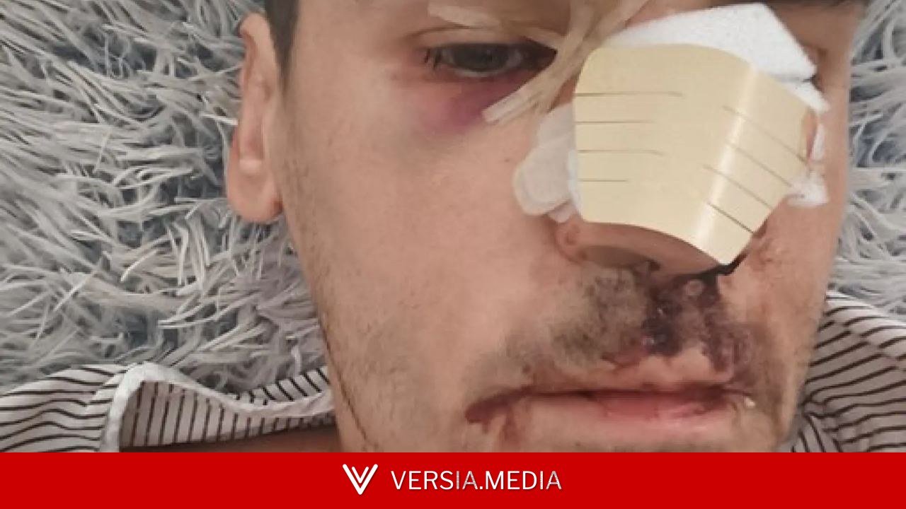 El periodista Fonsi Loaiza denuncia haber sufrido una agresión en Cádiz: 