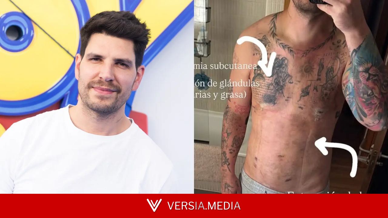 Diego Matamoros se somete a una mastectomía subcutánea y habla del uso de anabolizantes: