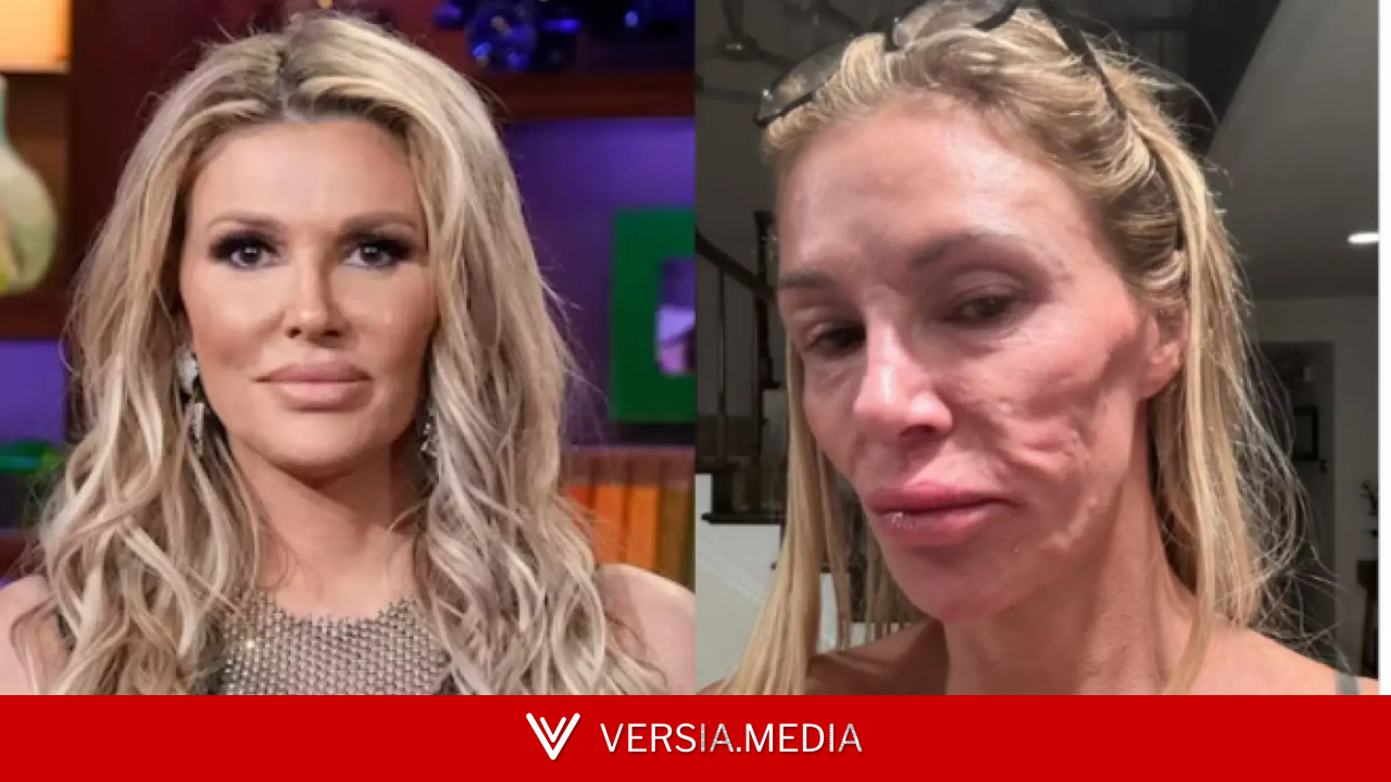 El calvario de una 'influencer' de EEUU: tres años de pruebas y sigue sin saber por qué su cara se deformó